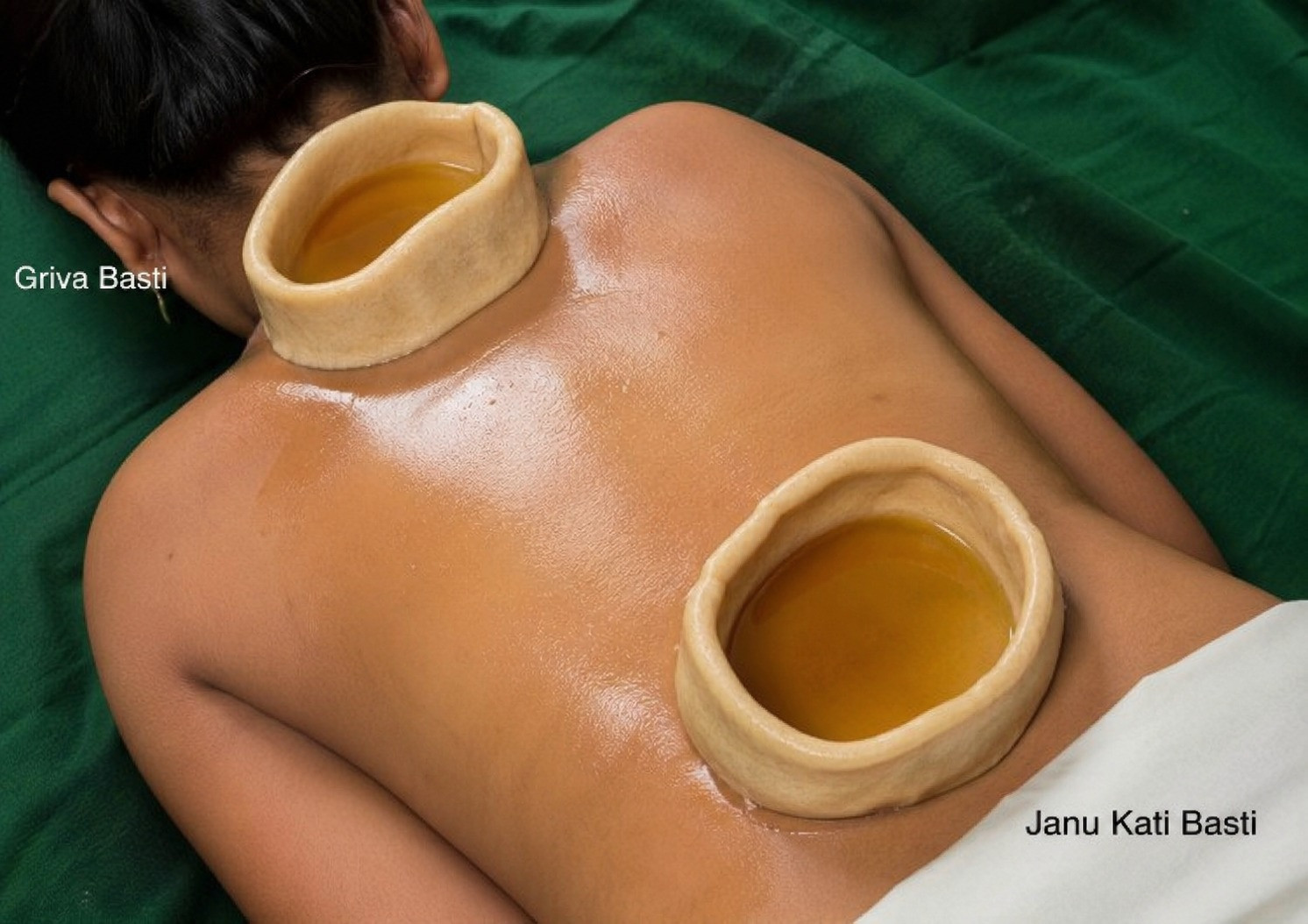 Basti Kriya (Medicated Oil Therapy)